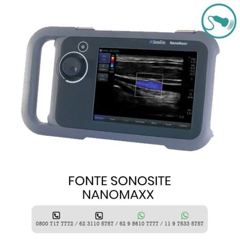 Assistência Técnica Sonosite Brasil