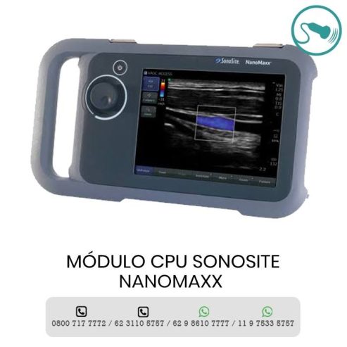 Assistência Técnica Sonosite Brasil