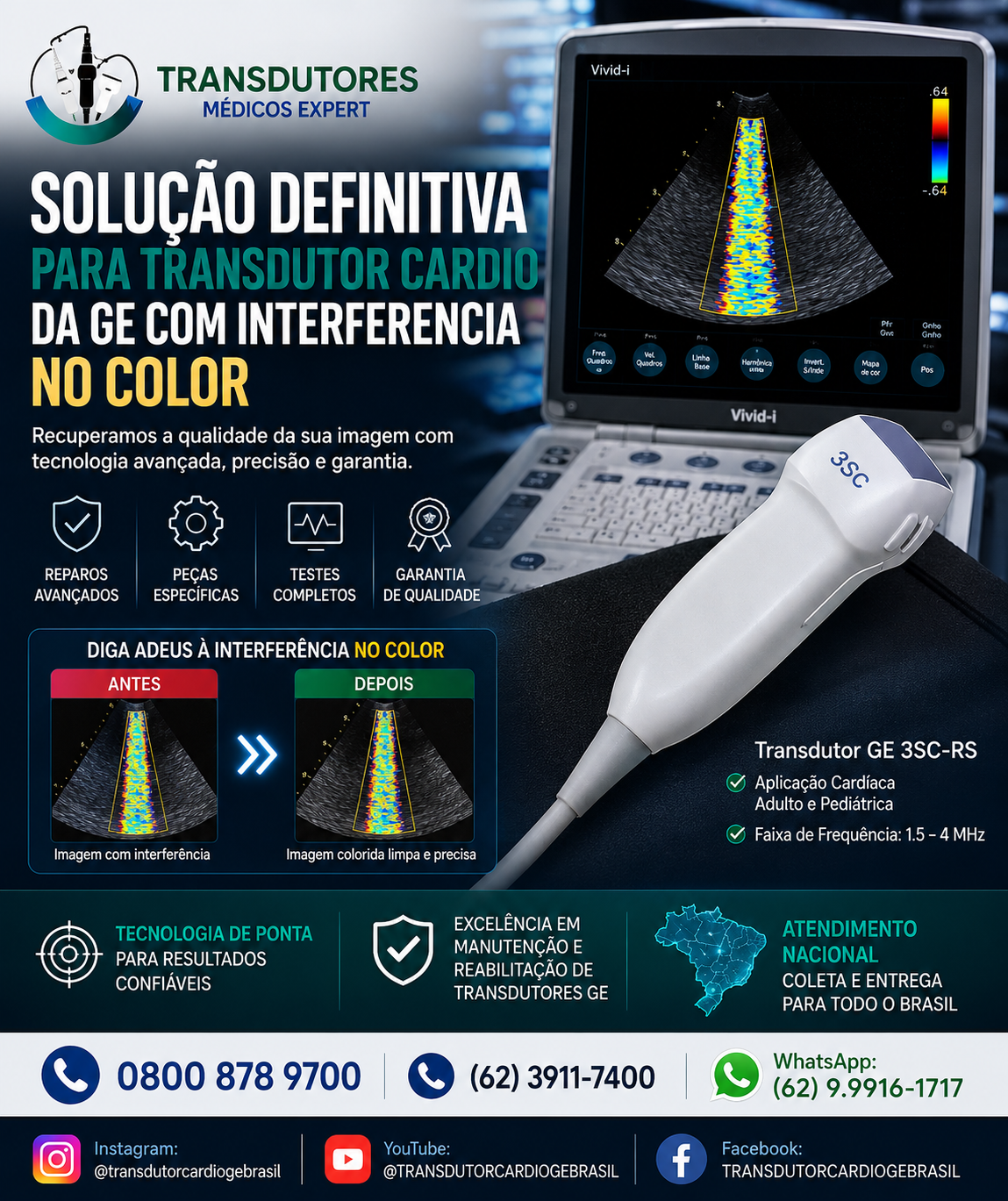 SOLUÇÃO-PARA-TRANSDUTOR-CARDIO-GE-3SC-RS-COM-ARTEFATOS-LINEA